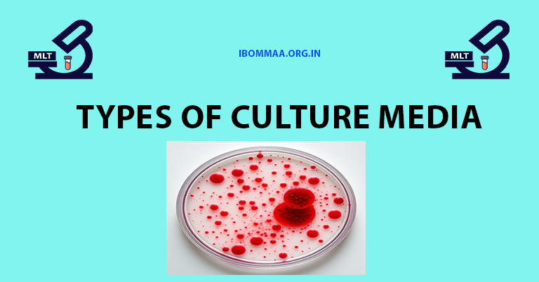 Types of culture media