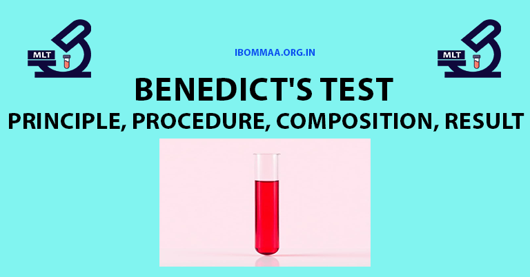 Benedict's Test: Principle, Procedure, Composition, Results