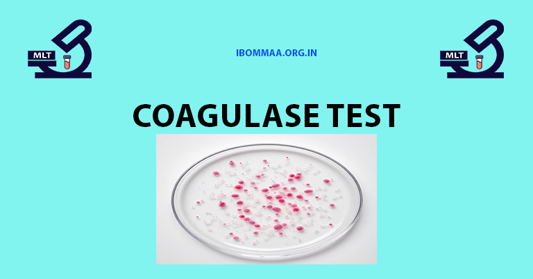 Coagulase Test in Microbiology: Principle, Procedure, and Interpretation