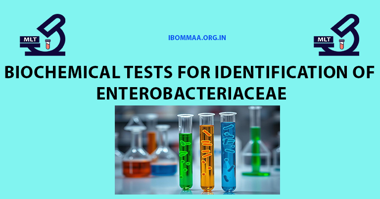 Biochemical Tests for Identification of Enterobacteriaceae